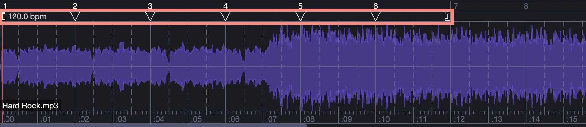 Bracketed playback zone